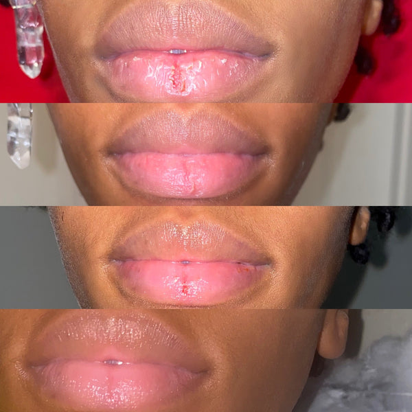 CHAP ELIMINATOR LIP BALM